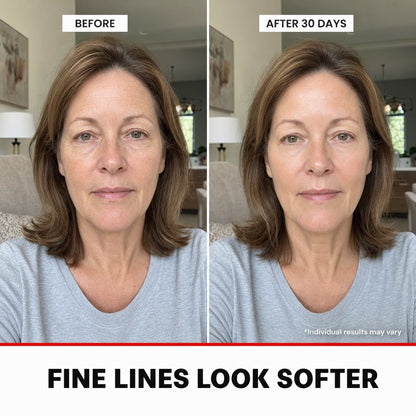 Before and after 30 days, fine lines look softer